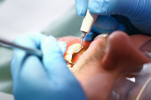 Best Emergency Treatment for Toothache in Cardington, OH